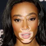 Winnie Harlow